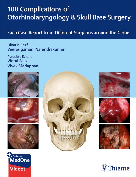 100 Complications of Otorhinolaryngology & Skull Base Surgery Original PDF