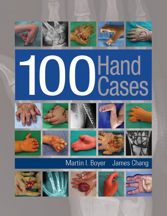 100 Hand Cases Original PDF
