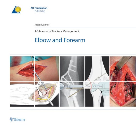 AO Manual of Fracture Management - Elbow and Forearm Original PDF