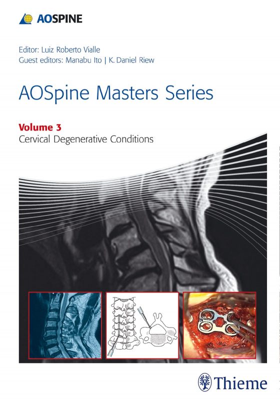 AOSpine Masters Series Volume 3: Cervical Degenerative Conditions Original PDF