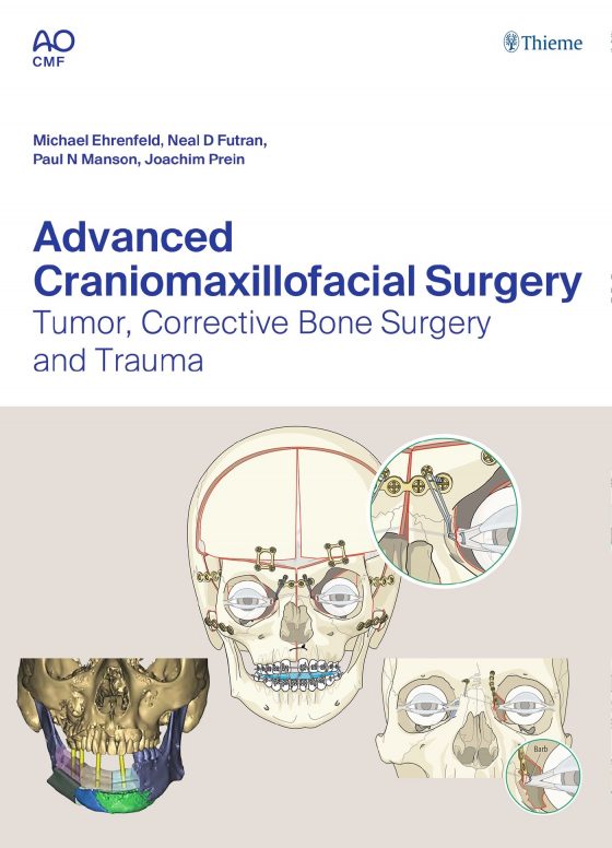 Advanced Craniomaxillofacial Surgery Original PDF