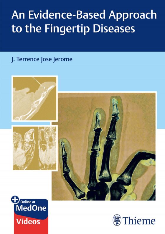 An Evidence-Based Approach to the Fingertip Diseases Original PDF