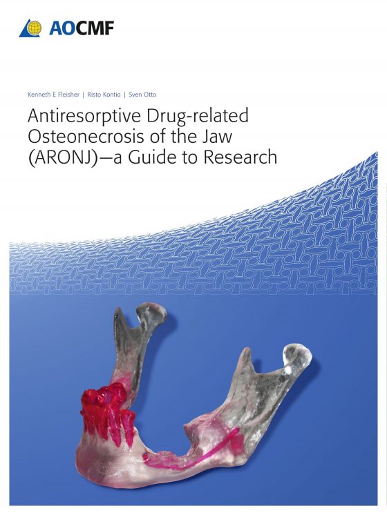 Antiresorptive Drug-Related Osteonecrosis of the Jaw (ARONJ) - A Guide to Research Original PDF