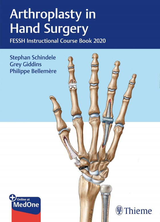 Arthroplasty in Hand Surgery Original PDF