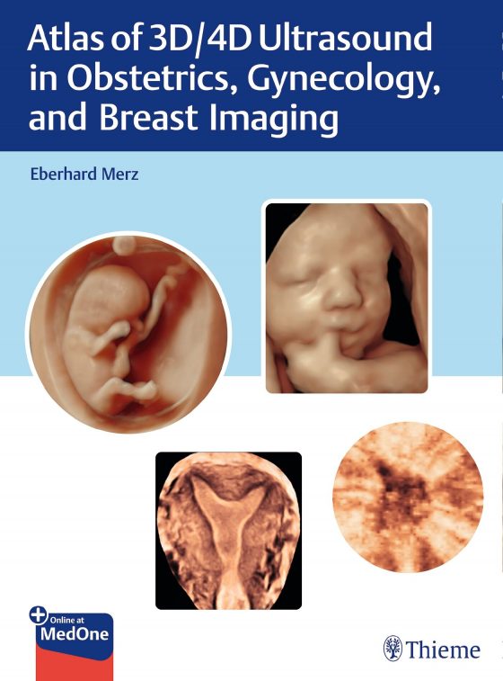 Atlas of 3D/4D Ultrasound in Obstetrics, Gynecology, and Breast Imaging Original PDF
