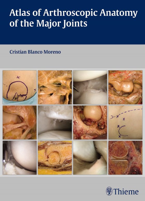 Atlas of Arthroscopic Anatomy of the Major Joints Original PDF