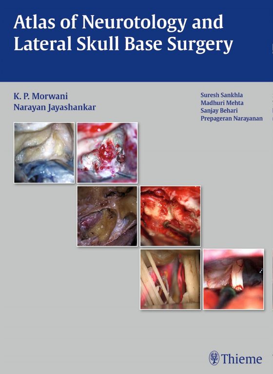 Atlas of Neurotology and Lateral Skull Base Surgery Original PDF