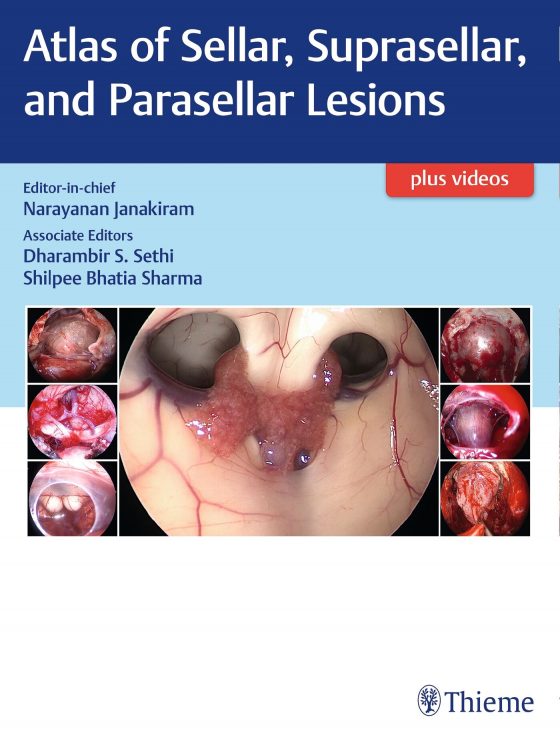 Atlas of Sellar, Suprasellar, and Parasellar Lesions Original PDF