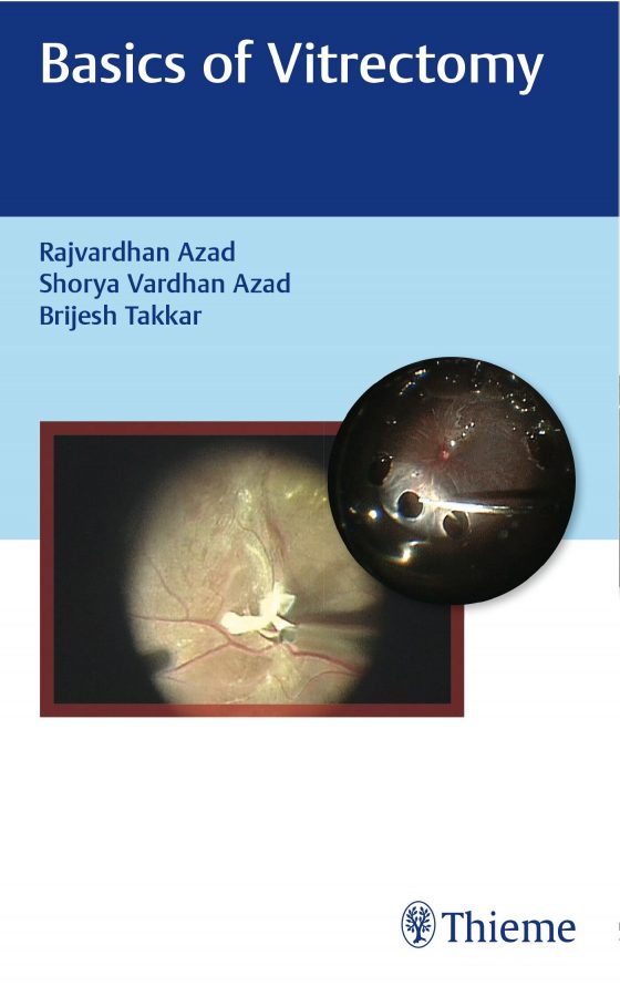 Basics of Vitrectomy Original PDF