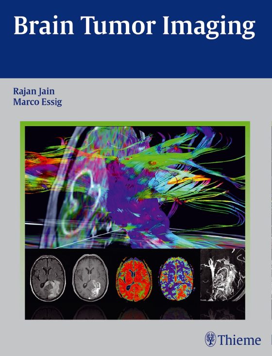 Brain Tumor Imaging Original PDF