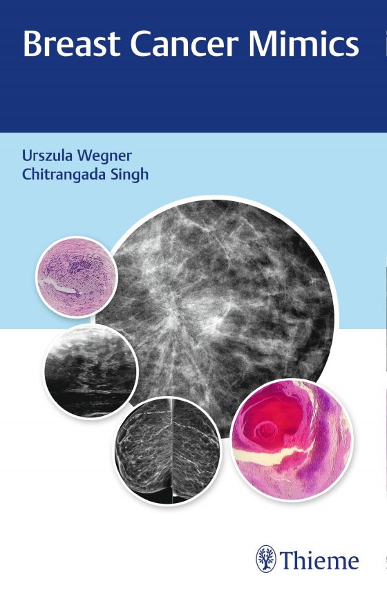 Breast Cancer Mimics Original PDF