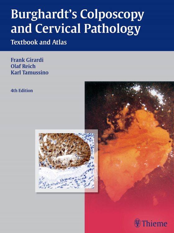 Burghardt's Colposcopy and Cervical Pathology Original PDF
