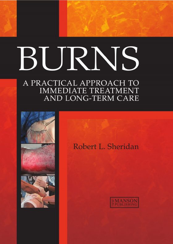 Burns Original PDF