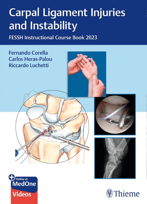 Carpal Ligament Injuries and Instability Original PDF