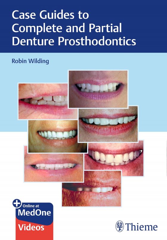Case Guides to Complete and Partial Denture Prosthodontics Original PDF
