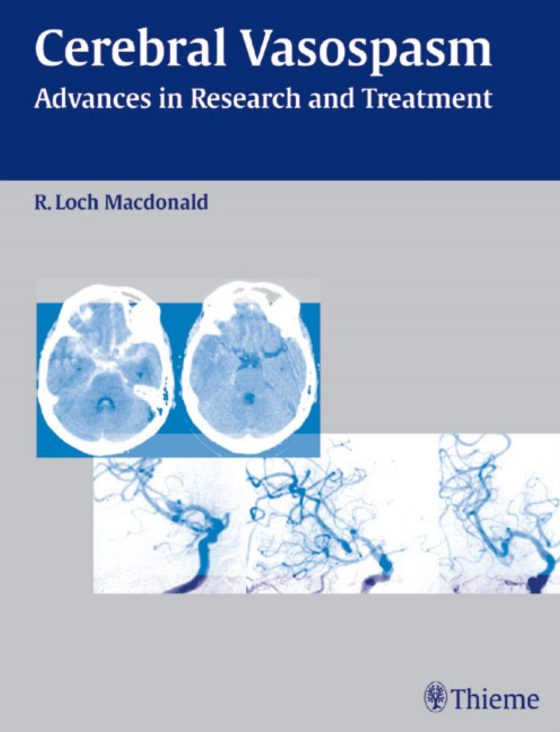 Cerebral Vasospasm Original PDF