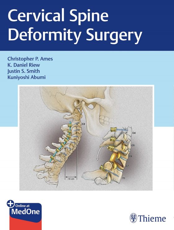 Cervical Spine Deformity Surgery Original PDF