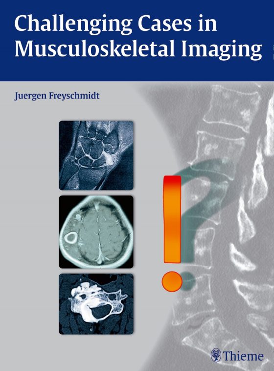 Challenging Cases in Musculoskeletal Imaging Original PDF