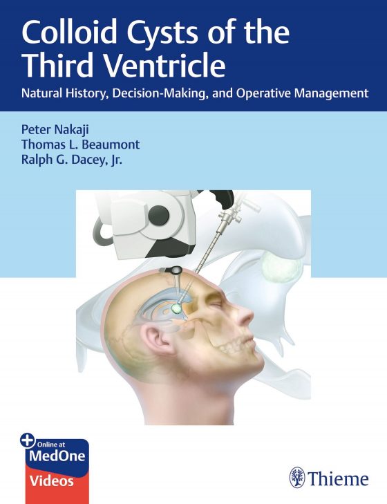Colloid Cysts of the Third Ventricle Original PDF