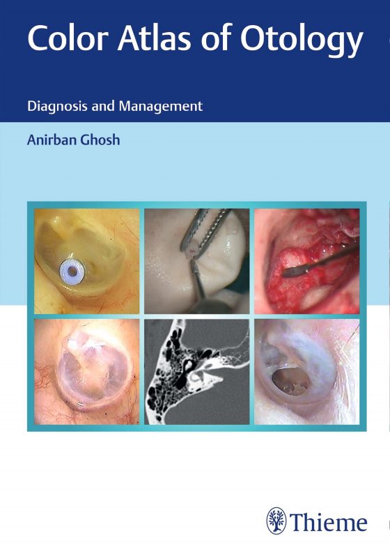 Color Atlas of Otology Original PDF