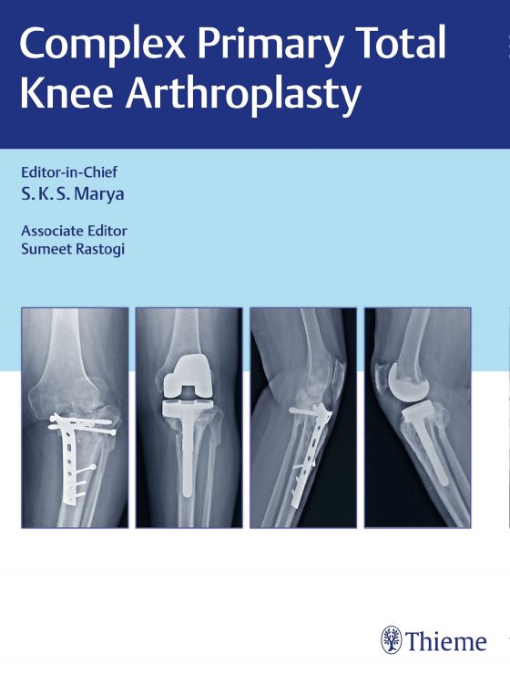 Complex Primary Total Knee Arthroplasty Original PDF