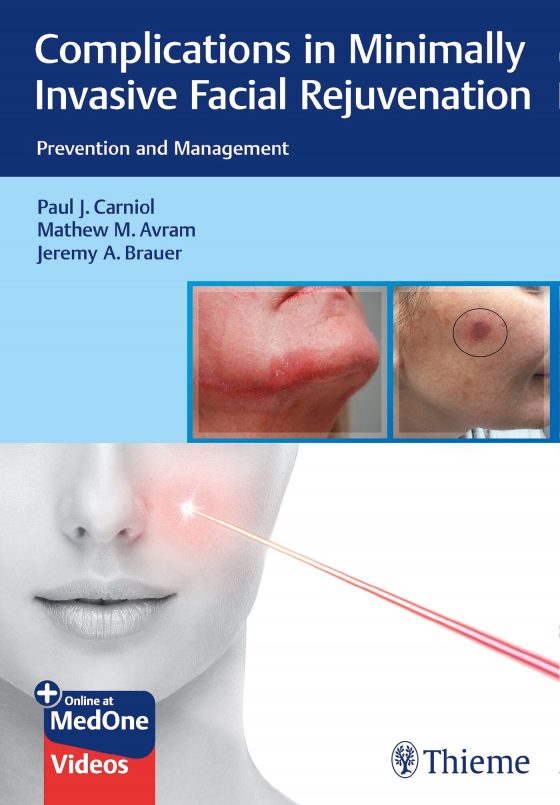 Complications in Minimally Invasive Facial Rejuvenation Original PDF