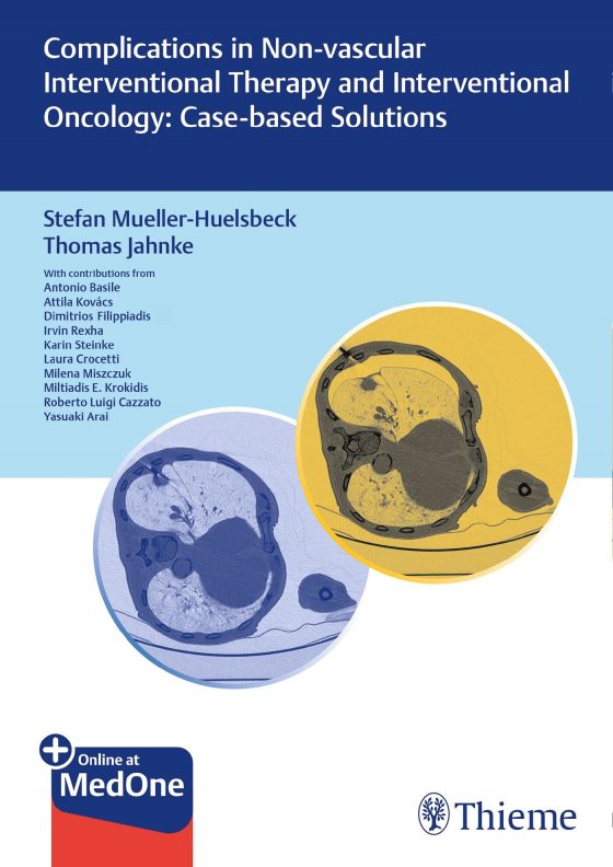 Complications in Non-vascular Interventional Therapy and Interventional Oncology: Case-based Solutions Original PDF