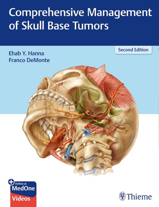Comprehensive Management of Skull Base Tumors Original PDF