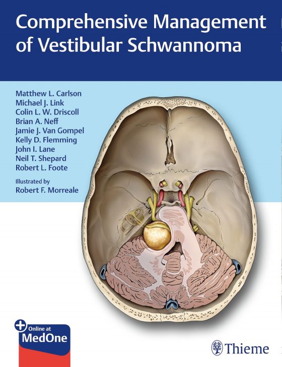 Comprehensive Management of Vestibular Schwannoma Original PDF