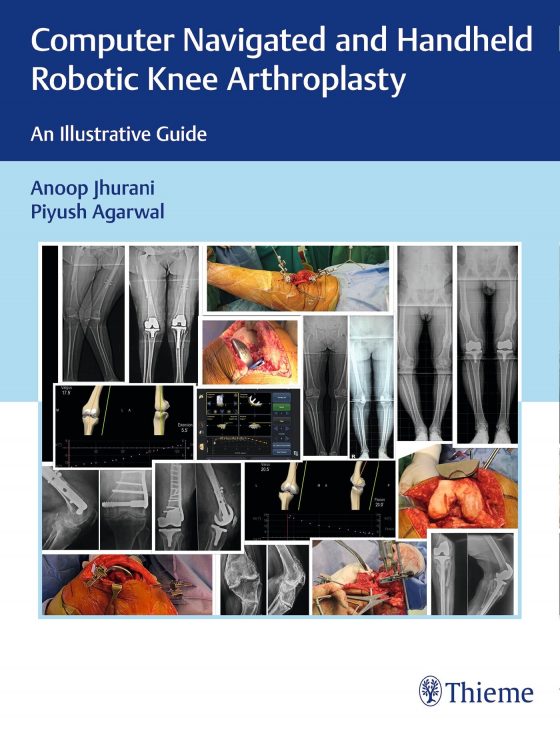 Computer Navigated and Handheld Robotic Knee Arthroplasty Original PDF