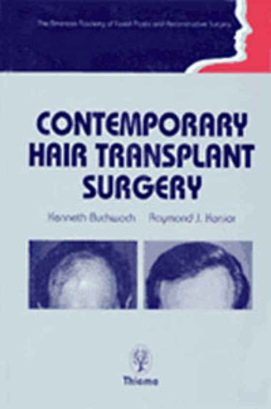 Contemporary Hair Transplant Surgery Original PDF