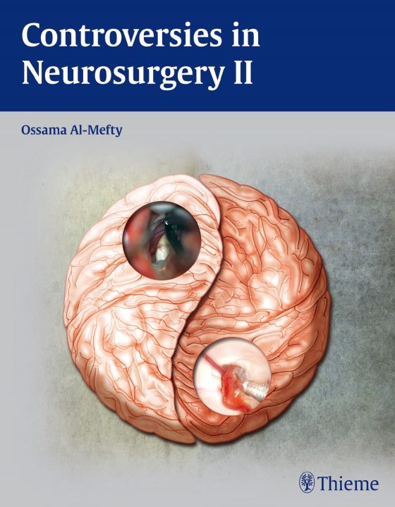Controversies in Neurosurgery II Original PDF