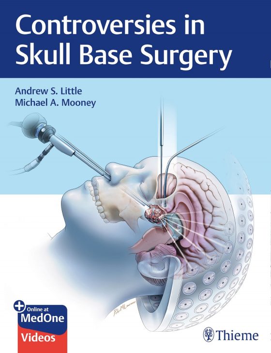 Controversies in Skull Base Surgery Original PDF