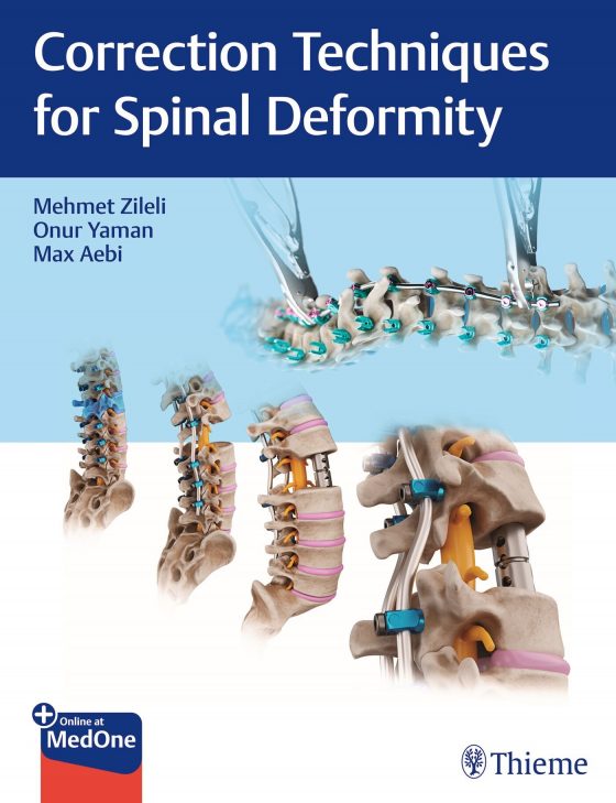Correction Techniques for Spinal Deformity Original PDF