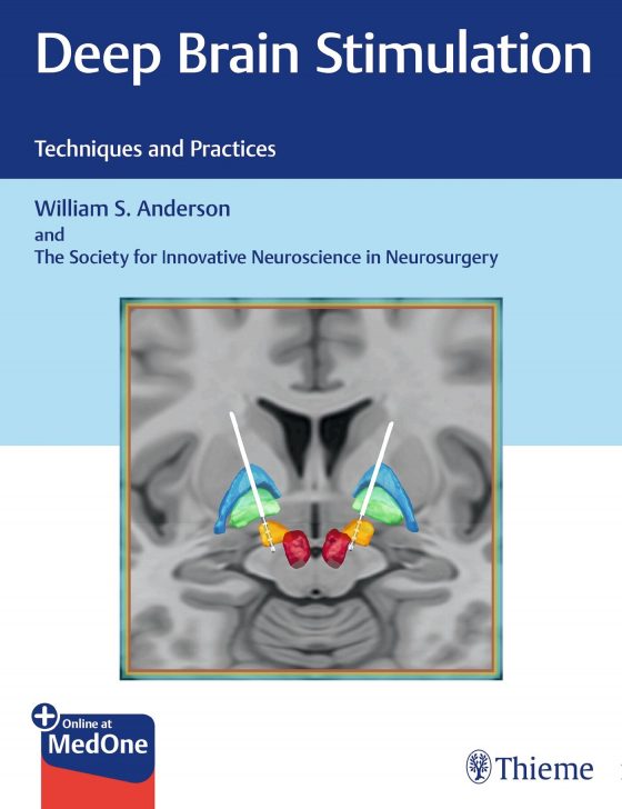 Deep Brain Stimulation Original PDF