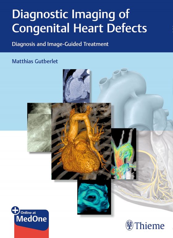 Diagnostic Imaging of Congenital Heart Defects Original PDF
