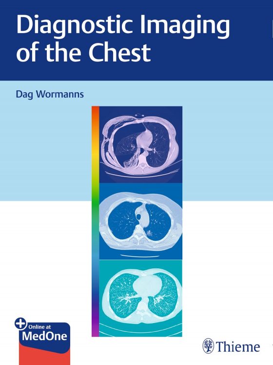 Diagnostic Imaging of the Chest Original PDF