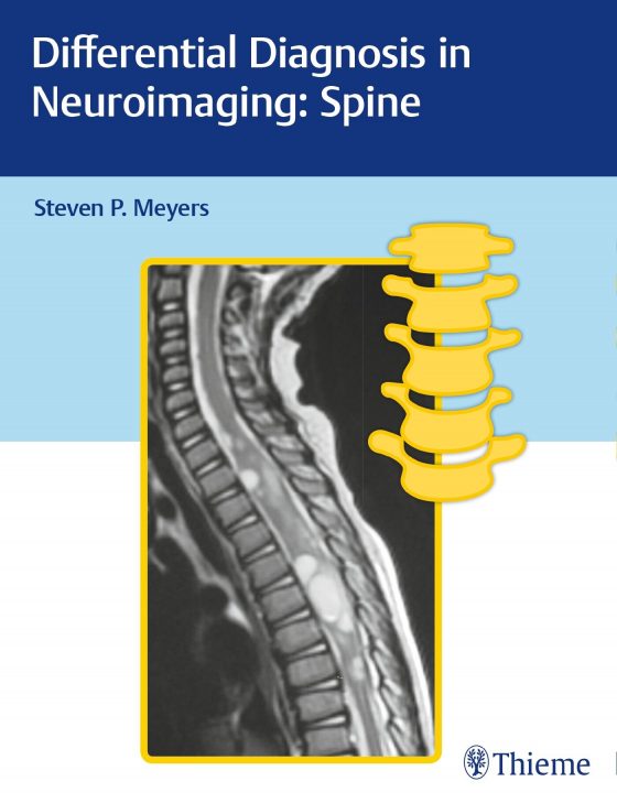Differential Diagnosis in Neuroimaging: Spine Original PDF