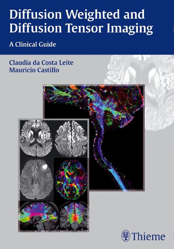 Diffusion Weighted and Diffusion Tensor Imaging Original PDF