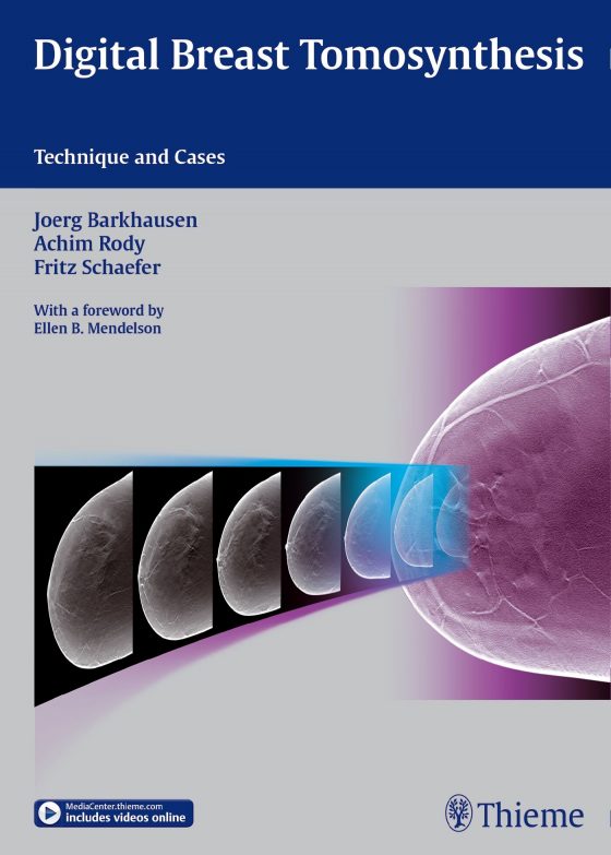 Digital Breast Tomosynthesis Original PDF