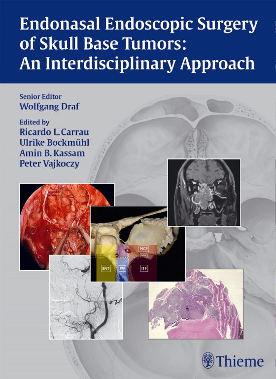 Endonasal Endoscopic Surgery of Skull Base Tumors: An Interdisciplinary Approach Original PDF