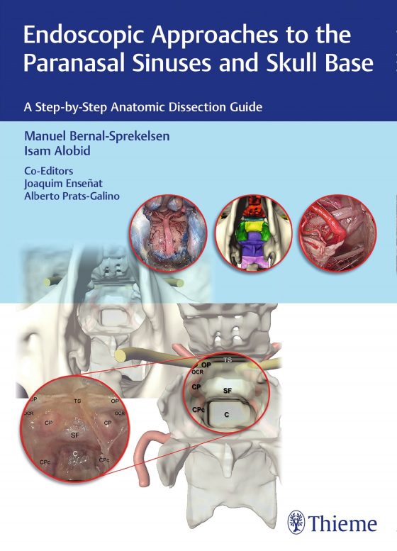 Endoscopic Approaches to the Paranasal Sinuses and Skull Base Original PDF
