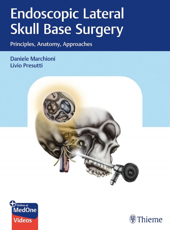 Endoscopic Lateral Skull Base Surgery Original PDF