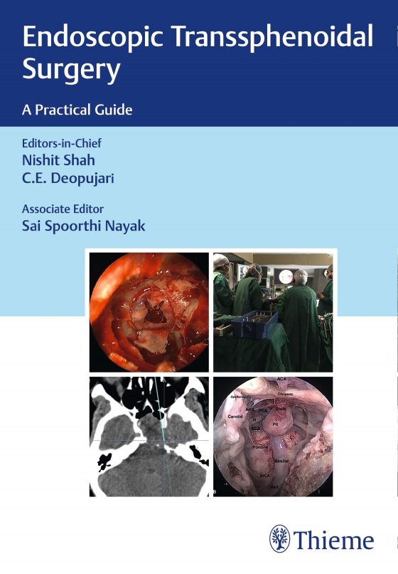 Endoscopic Transsphenoidal Surgery Original PDF