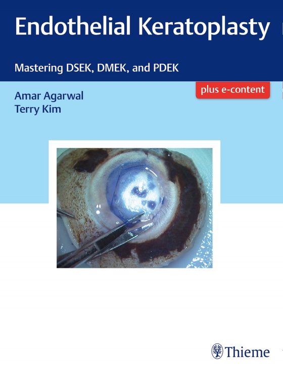 Endothelial Keratoplasty Original PDF