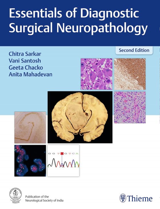 Essentials of Diagnostic Surgical Neuropathology Original PDF