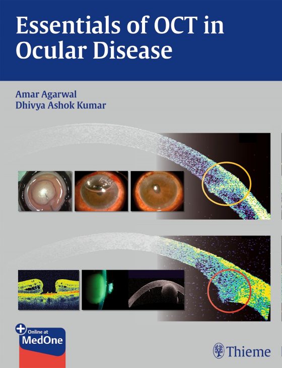 Essentials of OCT in Ocular Disease Original PDF