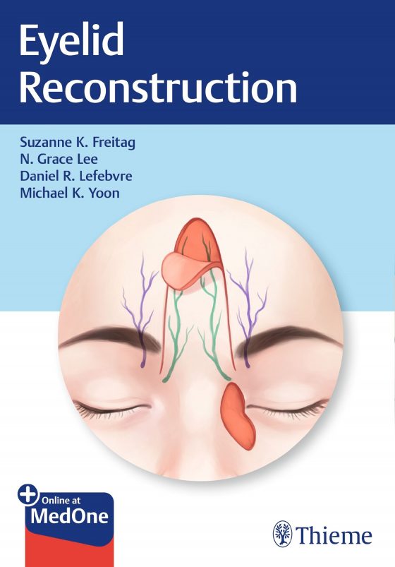 Eyelid Reconstruction Original PDF