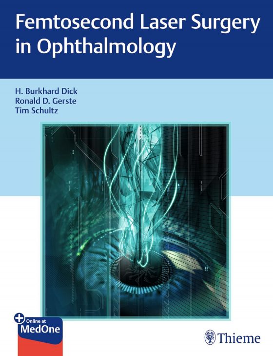 Femtosecond Laser Surgery in Ophthalmology Original PDF