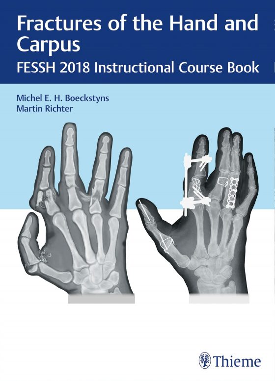 Fractures of the Hand and Carpus Original PDF